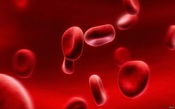 آنچه باید درباره کم خونی بدانید + درمان
