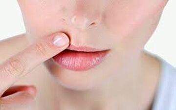 این خوراکی‌ها برای درمان تبخال مفیدند

