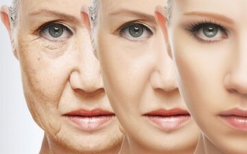 هر آنچه که باید درباره رفع طبیعی چین و چروک پوست بدانید