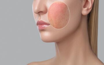 چهار کار خطرناک که پوستتان را خراب می‌کند