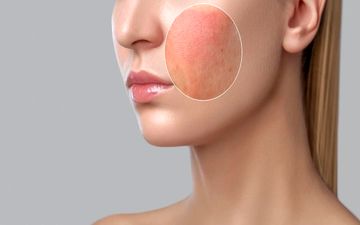 چهار کار خطرناک که پوستتان را خراب می‌کند