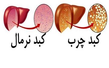اگر نوزاد شیر مادر کافی نخورد به این بیماری دچار خواهد شد! 