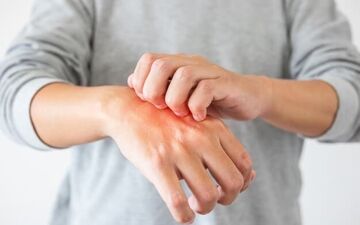 ۶ راز طلایی برای داشتن پوستی نرم و لطیف| جلوگیری از خشکی پوست با راهکارهای ساده