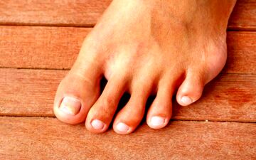 زرد شدن ناخن دست و پا نشانه چیست؟