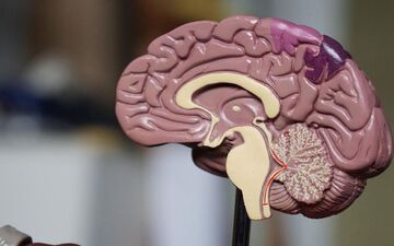 این نشانه ها می گوید سکته مغزی در راه است