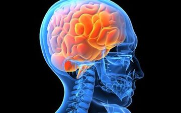  برای جلوگیری از بروز سکته مغزی چه کارهایی باید انجام بدیم
