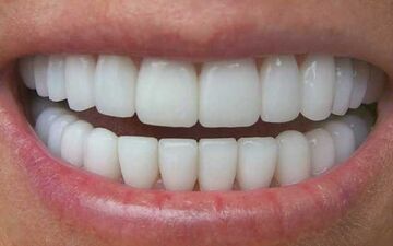 چه خوراکی‌هایی برای سلامت دندان بخوریم؟