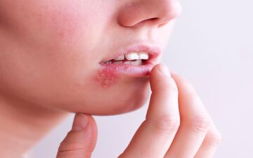 تبخال دهانی چقدر خطرناک است؟ یافته‌های جدید و نگران‌کننده دانشمندان 