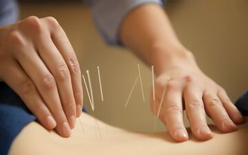 طب سوزنی واقعا درد را کاهش می‌دهد؟ 