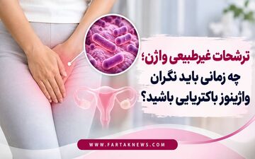 ترشحات غیرطبیعی واژن؛ چه زمانی باید نگران واژینوز باکتریایی باشید؟
