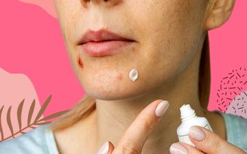 آیا استفاده از خمیر دندان برای بهبود جوش‌های صورت موثر است؟