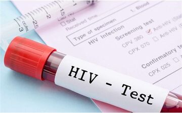  بیماران HIV اگر این نکات را بدانند سالم زندگی می کنند!