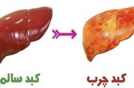 نوشیدنی‌های صبحگاهی برای کبد چرب
