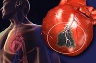 آیا بعداز حمله قلبی قلب دوباره میتواند مثل قبل شود؟