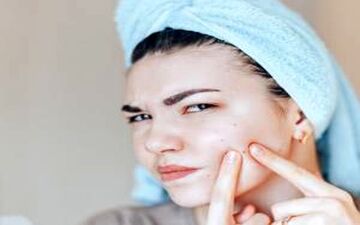 جوش های صورت چه زمانی نگران کننده می شوند؟