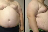 این عامل هم جزو عوامل مهم در ابتلا به سرطان است!