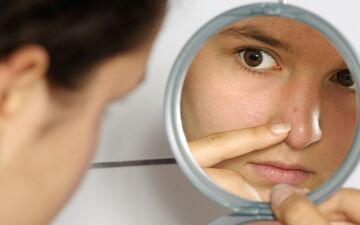 چه موقع بخاطر جوش روی بینی به پزشک مراجعه کنیم؟