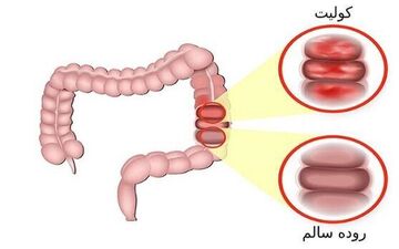 به این ۶ دلیل شما دچار مشکلات گوارشی می شوید