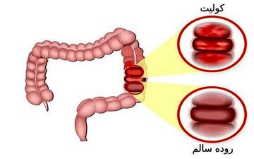 به این ۶ دلیل شما دچار مشکلات گوارشی می شوید