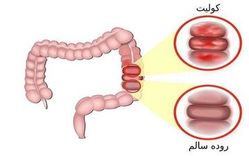 به این ۶ دلیل شما دچار مشکلات گوارشی می شوید