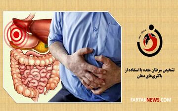 تشخیص سرطان معده با استفاده از باکتری‌های دهان