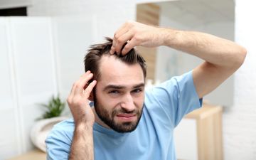 هشدار به کم‌خواب‌ها: کچلی، عاقبت بی‌خوابی‌های شما!