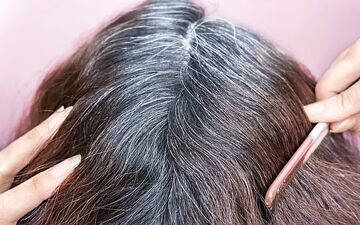  قبل از ۳۰ سالگی موهایتان سفید شده ؟ این مطلب را بخوانید

