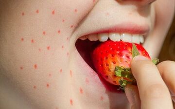 این علائم می‌گوید که دیگر نباید لب به توت‌فرنگی بزنید