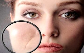محو کردن خط لبخند با این روغن گیاهی/ معجزه را واقعی ببینید!
