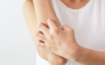 خارش اگزما را خیلی سریع تسکین دهید