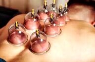 به هیچ عنوان در این مواقع حجامت نکنید!