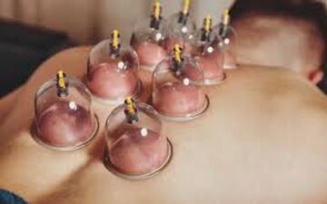 به هیچ عنوان در این مواقع حجامت نکنید!