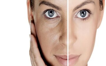دمنوش های مناسب برای جوانسازی و شادابی پوست