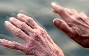 چگونه روند پارکینسون کند می‌شود؟