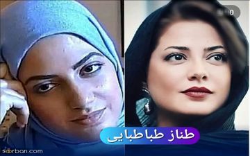 عروسک شدن این ۷ خانم بازیگر با عمل های زیبایی + اسامی و عکس های قبل و بعد !
