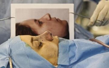 خانم های ایرانی در این عمل جراحی رکود دارند!