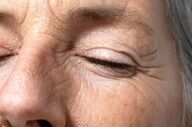 چگونه ظهور چین و چروک‌های صورت را به تأخیر بیندازیم؟