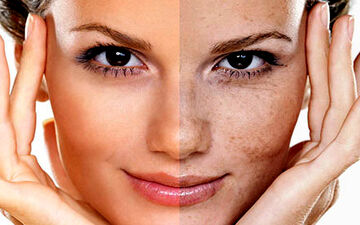 لک های پوستی را جدی بگیرید + فیلم