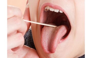 اگر زبان تان زردرنگ است این مطلب را بخوانید


