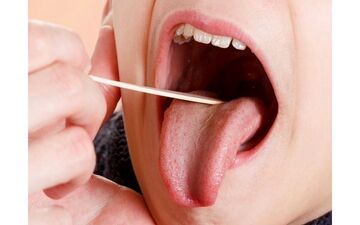 اگر زبان تان زردرنگ است این مطلب را بخوانید

