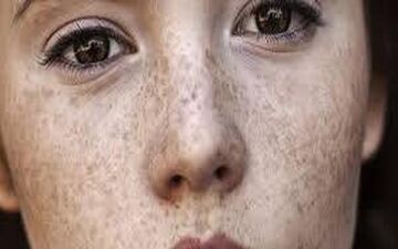 تتوی «کک مک» روی صورت دختران ایرانی ! 