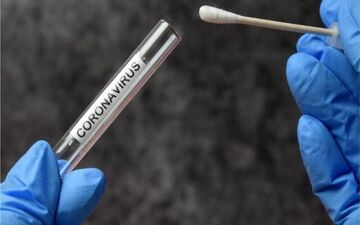 تست PCR یا سی‌تی‌اسکن؟کدام قابل اعتماد تر است؟