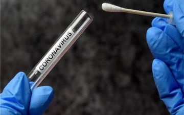 تست PCR یا سی‌تی‌اسکن؟کدام قابل اعتماد تر است؟