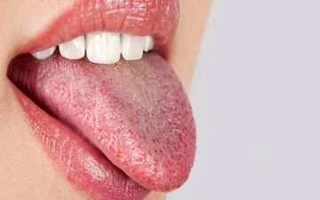 بگو زبانت چه رنگیه، تا بگم مشکلی تو بدنت وجود داره یا نه؟
