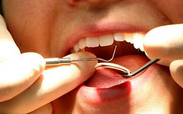 از نشانه های عفونت لثه آگاهی دارید؟