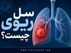 خطر بازگشت یک قاتل باستانی؛ از سرفه‌های ۳ هفته‌ای تا تعریق شبانه و خلط خونی با بیماری سل!