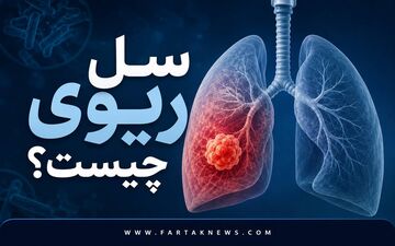 خطر بازگشت یک قاتل باستانی؛ از سرفه‌های ۳ هفته‌ای تا تعریق شبانه و خلط خونی با بیماری سل!
