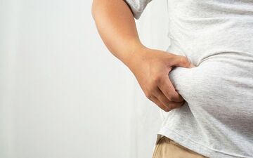 نیمی از افراد جامعه مشکل اضافه وزن دارند