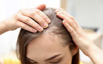  بایدها و نبایدهای مقابله با ریزش مو