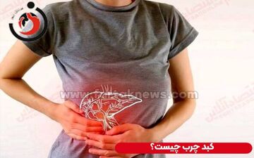 
10 غذای برتر شستشو دهنده کبد را می شناسید ؟

